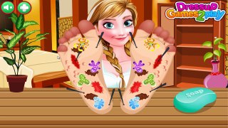 PLAY Frozen Anna Foot Doctor | NEW Game 2016 [HD]