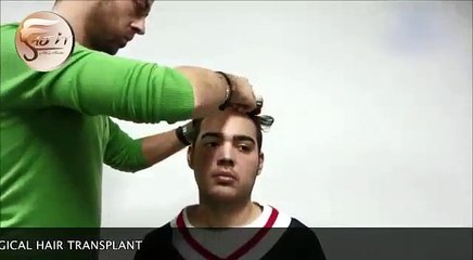 Non Surgical Hair Replacement