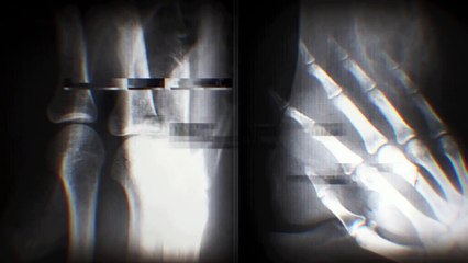 Thousand Foot Krutch Running With Giants (Lyric Video)