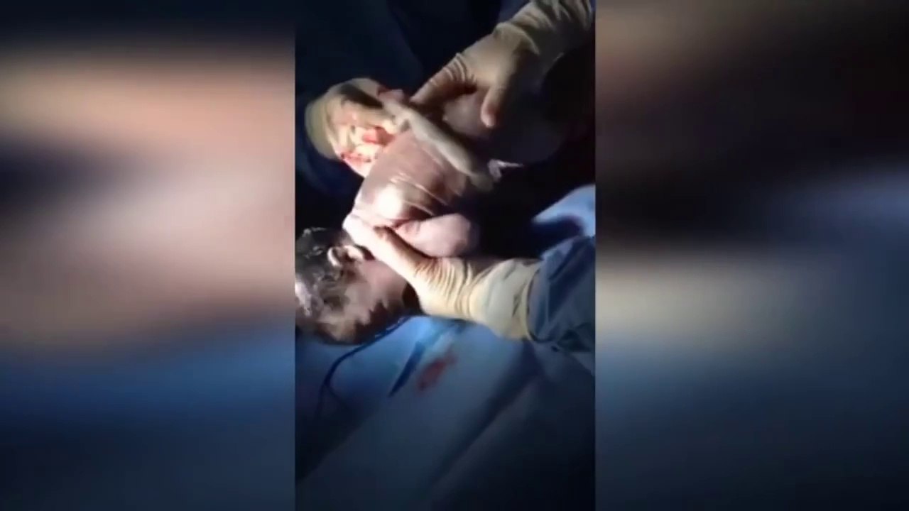 Quand les docteurs voient ce bébé sortir de sa mère, ils sortent vite les caméras!