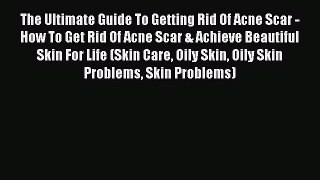 [PDF] The Ultimate Guide To Getting Rid Of Acne Scar - How To Get Rid Of Acne Scar & Achieve