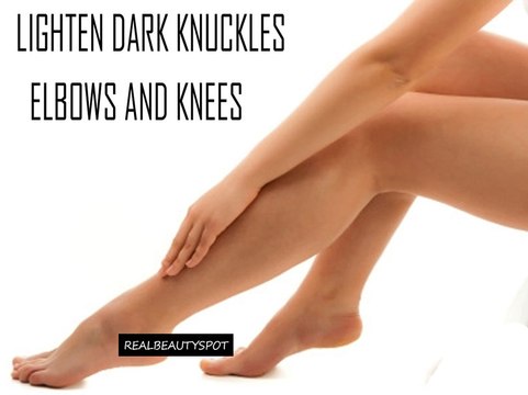 How to Get Rid of Dark Elbows and Knees Quickly - Effective Tips To Get Rid Of Black Knees And Elbow