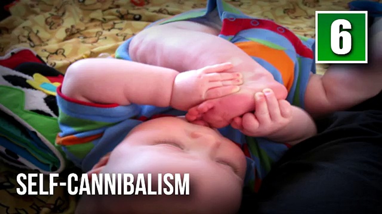 10 Most Bizarre Mental Disorders