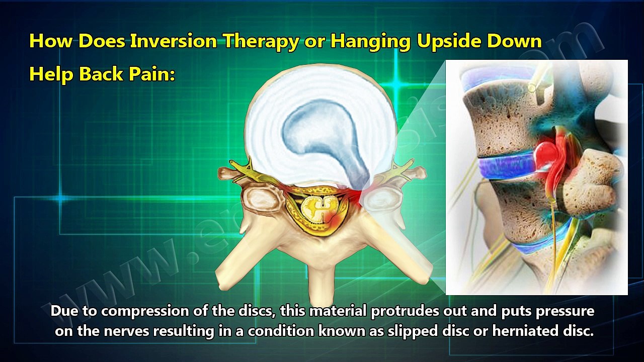How Does Inversion Therapy or Hanging Upside Down Help Back Pain