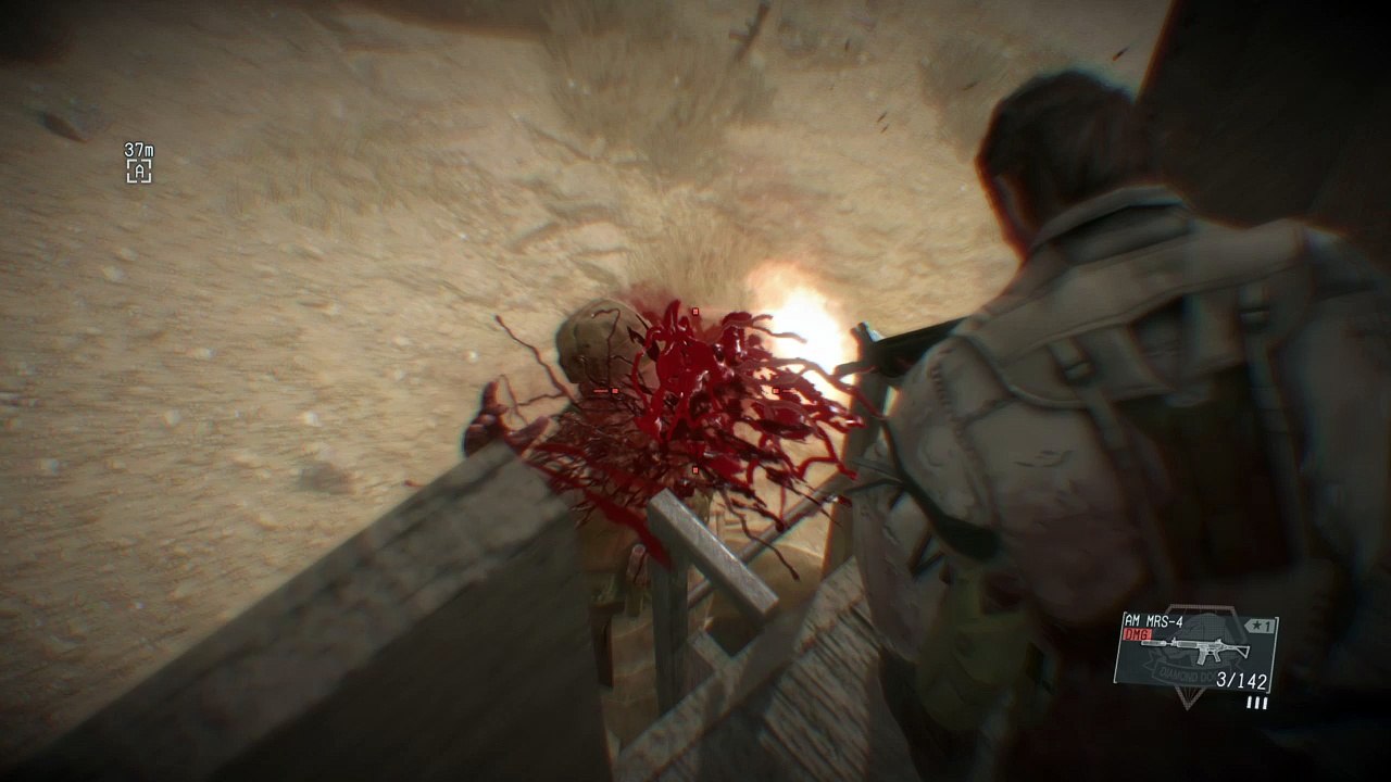 METAL GEAR SOLID V Nigga What?