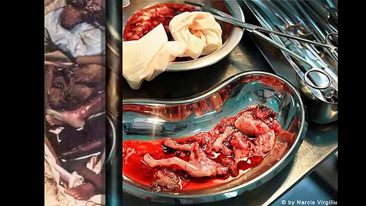 PHÁ THAI HÃY XEM VÀ CẢM NHẬN