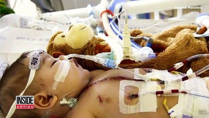 Parents of Dying Baby Who Got Last Minute Heart Transplant Say It