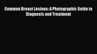 Download Common Breast Lesions: A Photographic Guide to Diagnosis and Treatment Ebook Free