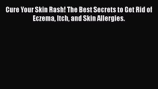 Read Cure Your Skin Rash! The Best Secrets to Get Rid of Eczema Itch and Skin Allergies. Ebook