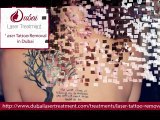 Tattoo Removal treatment in dubai