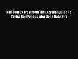 [Read Book] Nail Fungus Treatment:The Lazy Man Guide To Curing Nail Fungus Infections Naturally