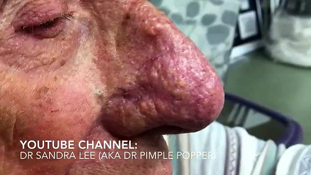 Guardate il naso di questo signore... NON CI CREDO...