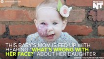 Mom Celebrates Daughter's Birthmark To Change The Conversation About Looking 