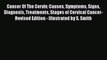 [PDF] Cancer Of The Cervix: Causes Symptoms Signs Diagnosis Treatments Stages of Cervical Cancer-