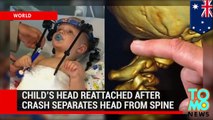 Head reattached after decapitation: Toddler's skull fused to spine after car crash - TomoNews