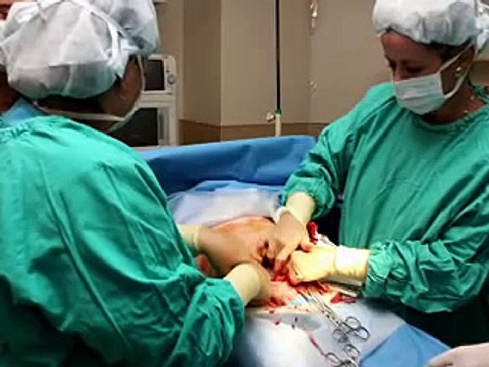 Breech Birth - Pregnancy Problems (Pregnancy Health Guru)