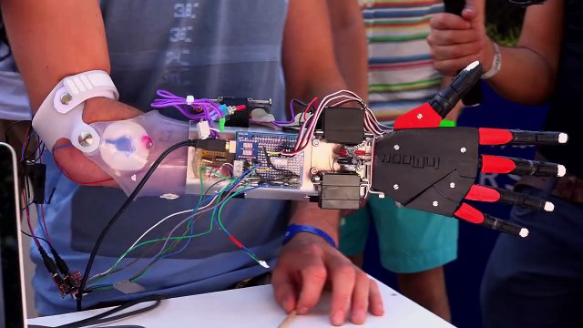 True Life | ‘Im a Cyborg Official Sneak Peek | MTV