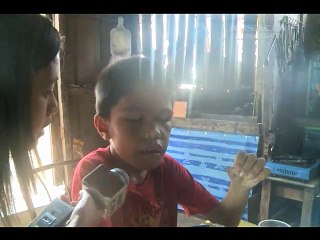 9-year-old boy from Cebu has 300 teeth