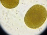 Réunion de cellules reproductrices mâles de la patelle avec des cellules reproductrices femelles du fucus