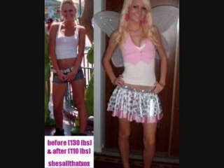 Extreme weight loss  before and after