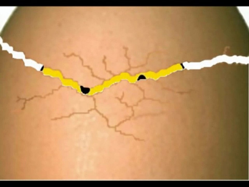 "Le Petit Poussin" dessin animé pour enfants  Dessins Animés Pour Enfants