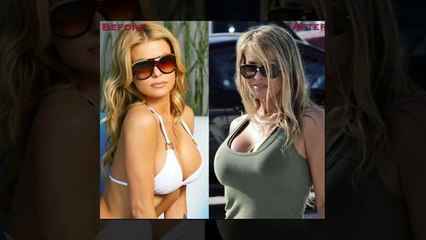 Top 10 Celebrities With the Most Expensive Breast Implants