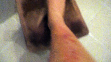 Bacağa taş ile vuruş sonrası 2