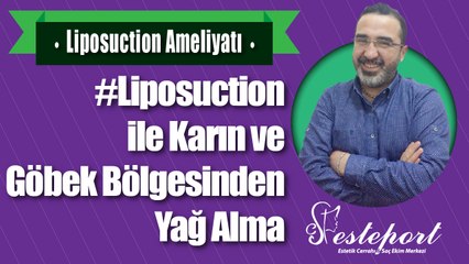 Liposuction ile Karın Bölgesinden Yağ Alma & Dr Ali Mezdeği