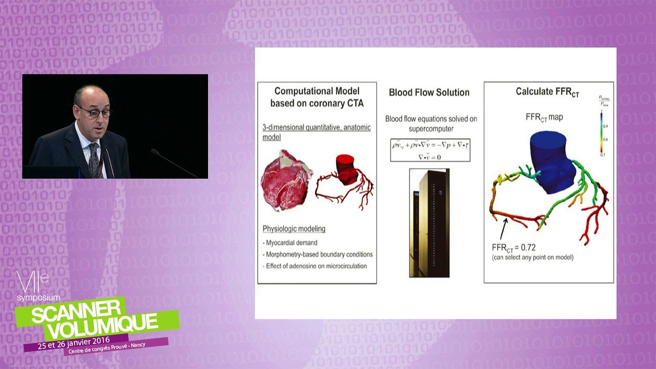 Perfusion cardiaque sous stress - Cutting Edge in cardiac imaging