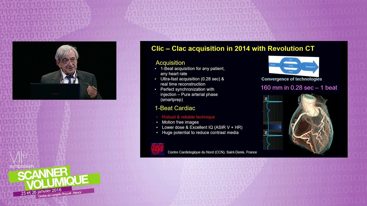 Prise en charge cardiopathie ischémique - Cutting Edge in cardiac imaging