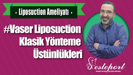 Vaser Liposuction Klasik Yönteme Üstünlükleri