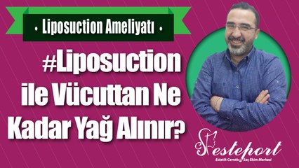 Liposuction ile Vücuttan ne Kadir Yağ Çekilir