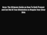 [PDF] Acne: The Ultimate Guide on How To Both Prevent and Get Rid Of Your Blemishes to Regain