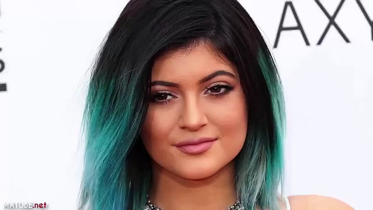 تحدي شفاه كيلي جينر -  ما هو ولماذا لا يجب عليك تجربته ؟!!