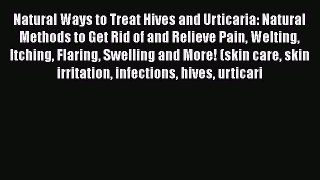 Read Natural Ways to Treat Hives and Urticaria: Natural Methods to Get Rid of and Relieve Pain