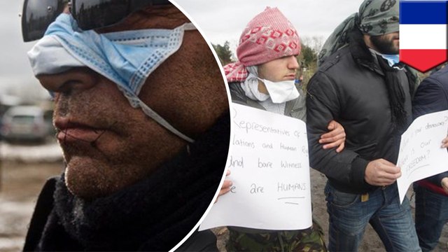 Migrants sew mouths shut in protest at the 'Jungle' camp in Calais, France