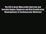 Download The ECG in Acute Myocardial Infarction and Unstable Angina: Diagnosis and Risk Stratification