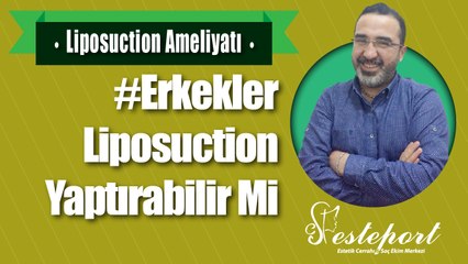 Erkeklerde Liposuction Güzel olur mu & Esteport Klinik