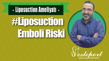 Liposuction Emboli ye Neden Olur Mu ?