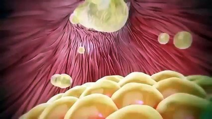 How Acne or Pimple Forms Under Skin