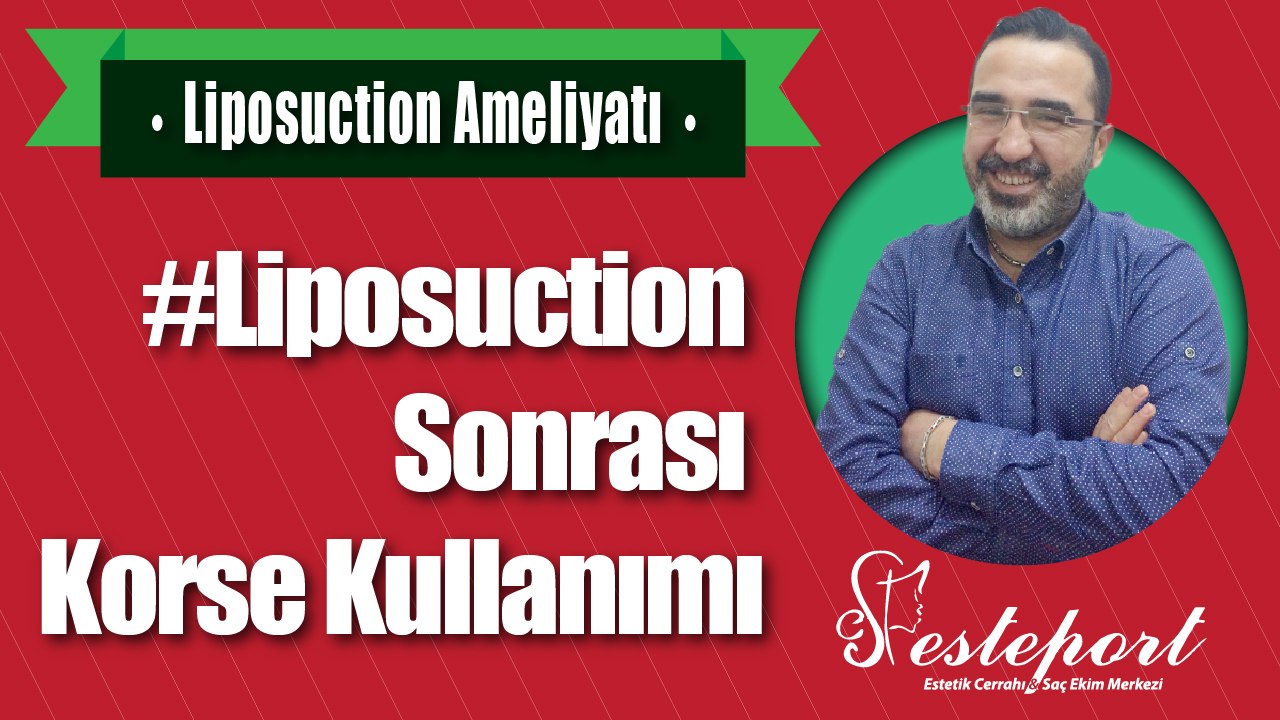 Liposuction Sonrası Korse Kullanımı