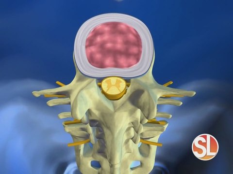 AZ Pain Centers offers spinal pain treatments