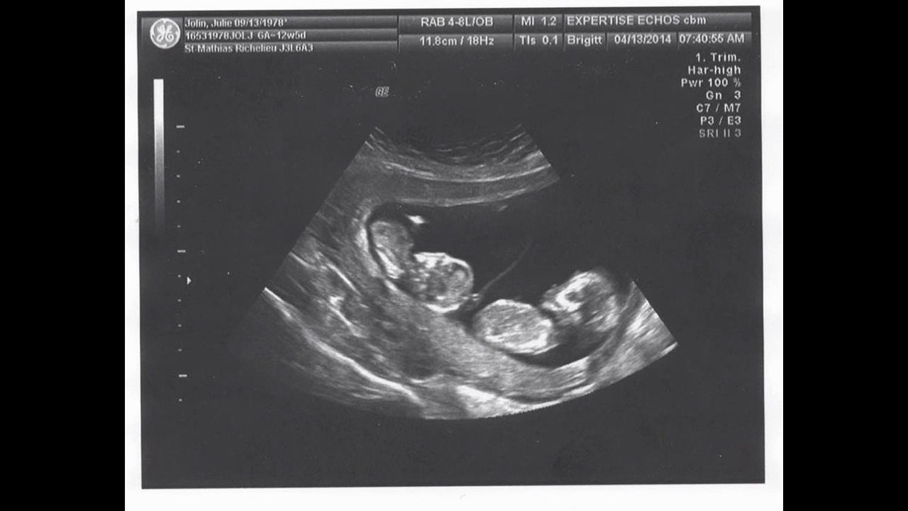 Buzzons contre le sexisme Groupe 2 Lycée Touchard