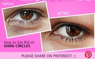 DIY Night Cream For Face_Under Eye - easy and effective I Homemade Eye Creams I How to Get Rid of DARK CIRCLES
