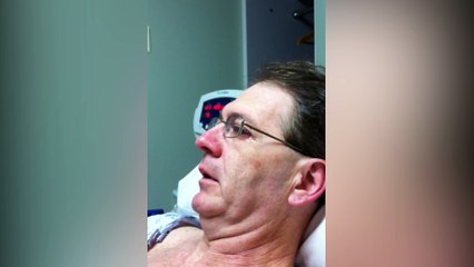 Disoriented Man Wants A Pet Monkey After Coming Out Of Surgery