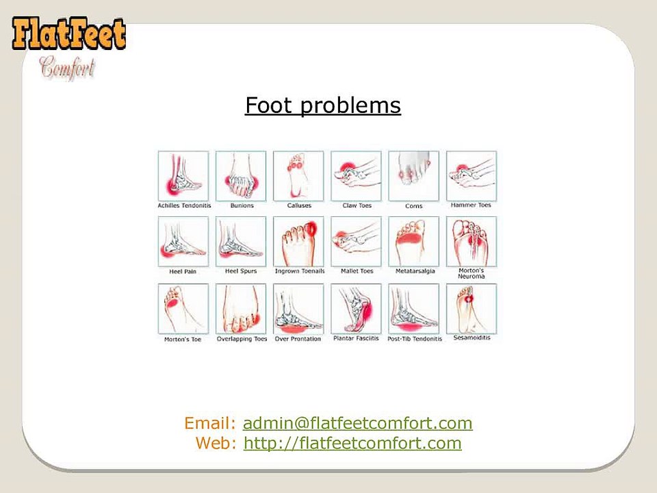 Running With Flat Feet