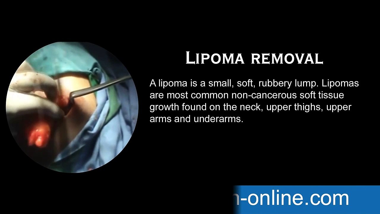 Cosmetic-Plastic Surgery Hospital Tamil Nadu - Aesthetic Surgeon Salem