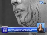Hombre denunció haber sido agredido por una ex-pareja y dos familiares