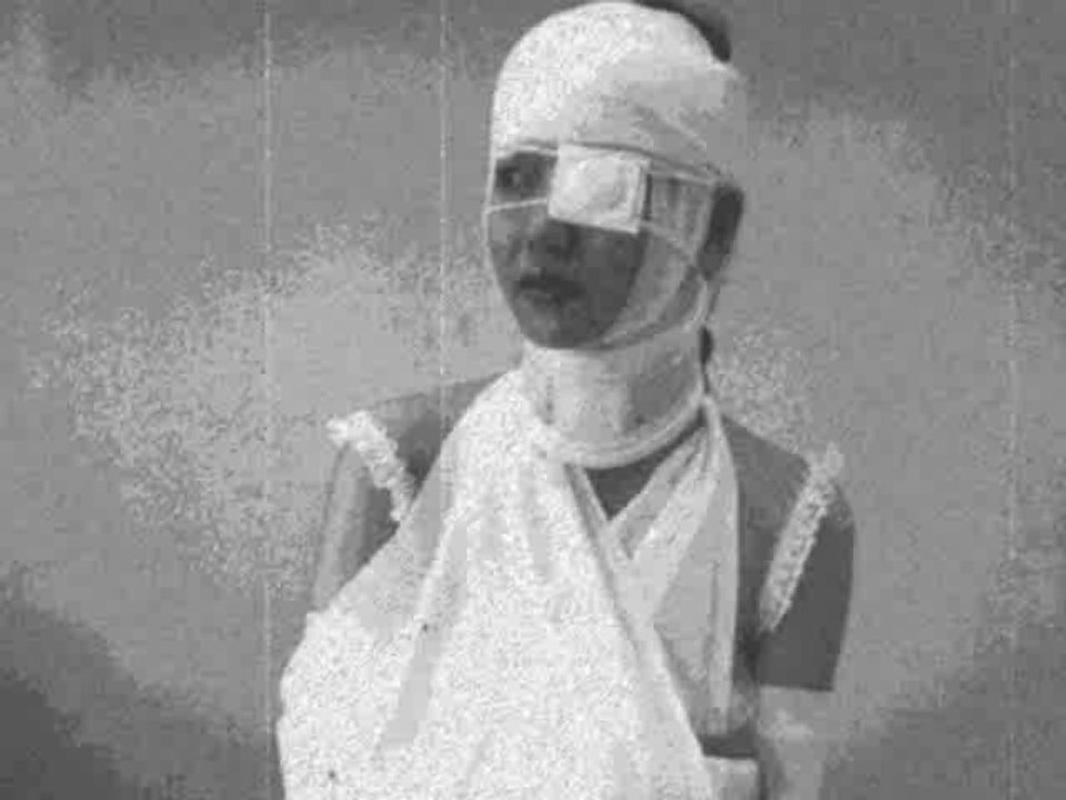 Glatze Des Willens - A5/ Balsam Auf Die Wunde