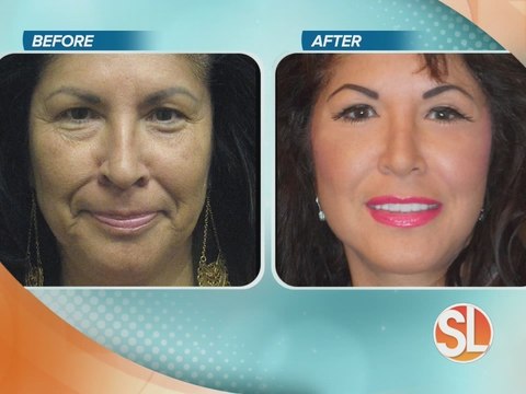 Dr.Thomas Kotoske uses his creative skill to customize your mommy makeover